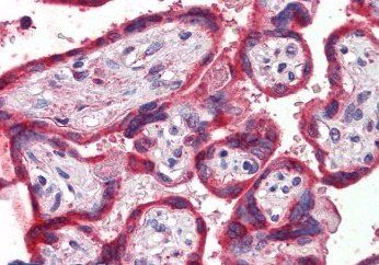 Thrombospondin Antibody