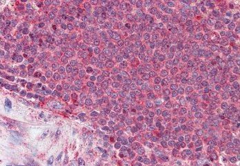Thrombospondin Antibody