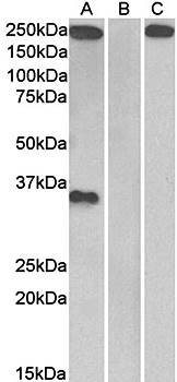 Thrombospondin Antibody