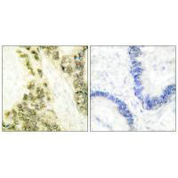 THRA Antibody