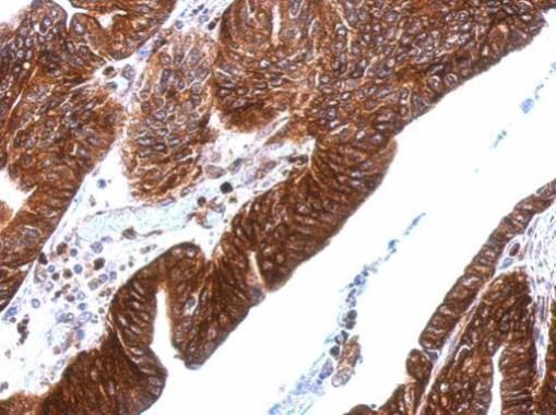 Thrombomodulin Rabbit Polyclonal Antibody