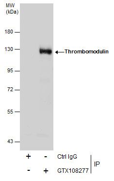 Thrombomodulin Rabbit Polyclonal Antibody