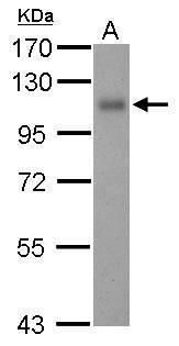 Thrombomodulin Rabbit Polyclonal Antibody