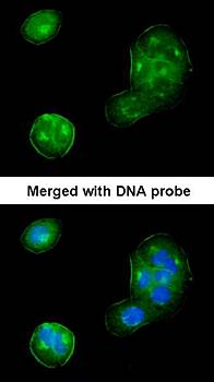 Thrombomodulin(CD141) antibody