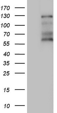 TYMP Antibody