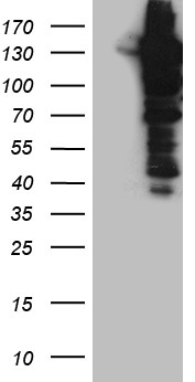 TDG Antibody
