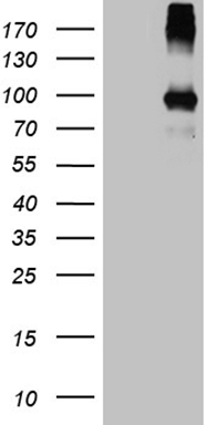 TDG Antibody