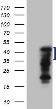 THRA Antibody
