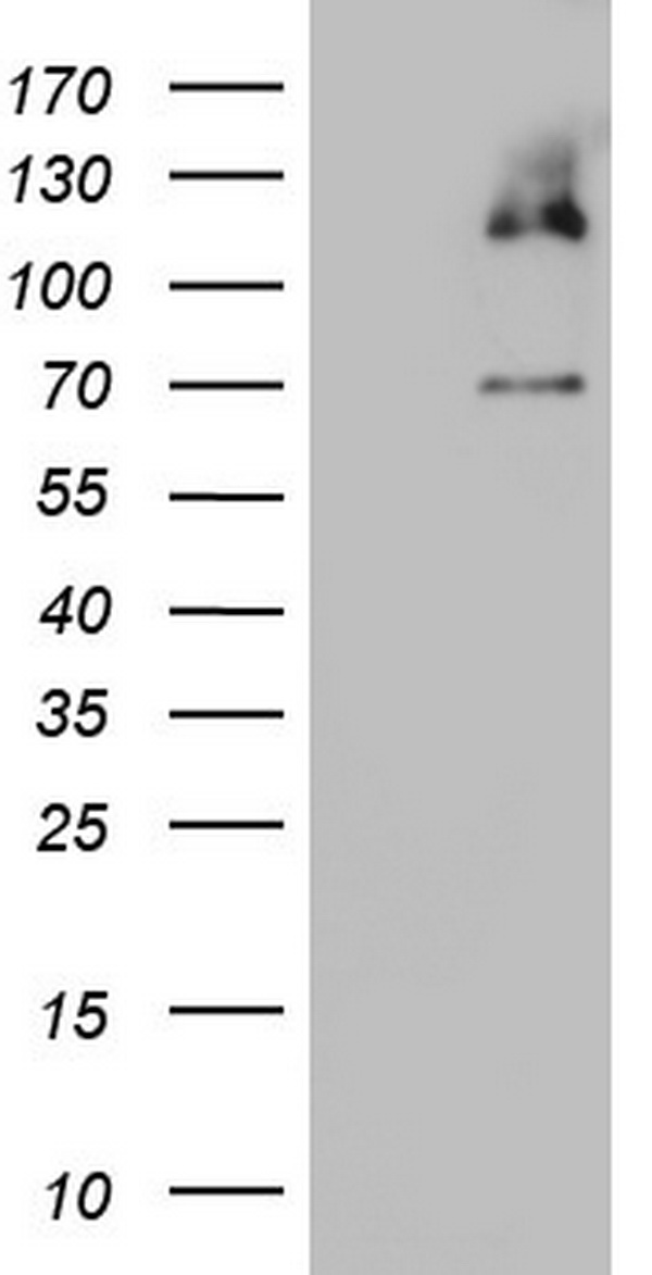 TRIM24 Antibody