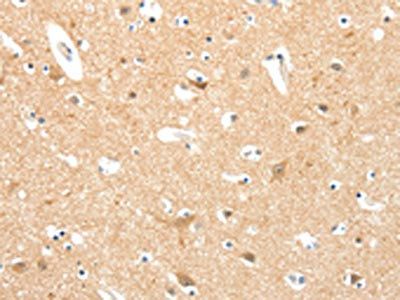 TIGAR Antibody
