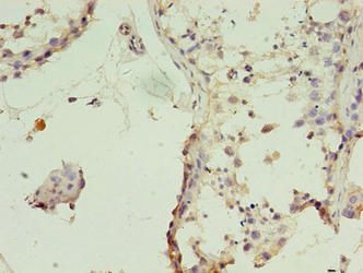 TIMM10B Antibody