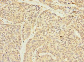 TIMM23 Antibody