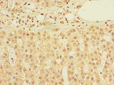 TIMM9 Antibody