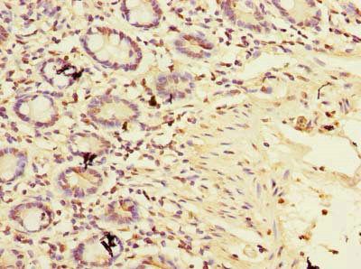 TIMM9 Antibody
