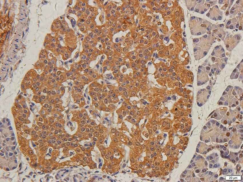 TIMP1 antibody