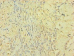 TIMP1 Antibody