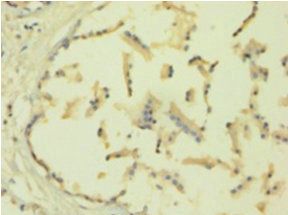 TIMP1 Antibody