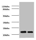 TIMP1 Antibody