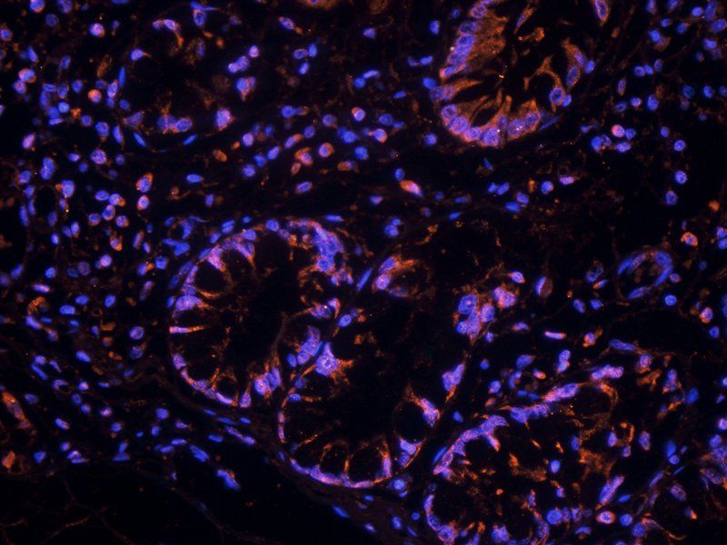 TIMP1 antibody