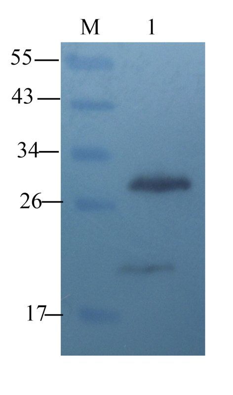 TIMP1 antibody