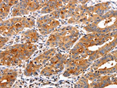 TIMP2 Antibody