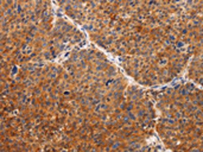 TIMP2 Antibody