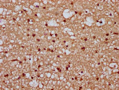 TIPARP Antibody