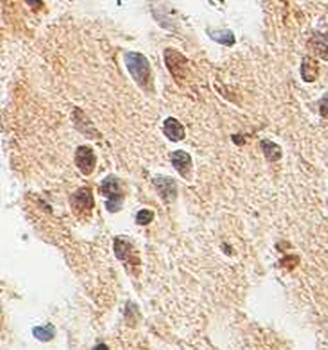 TLE4 Rabbit Polyclonal Antibody