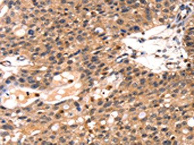 TLN1 Antibody