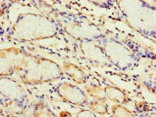 TLR1 Antibody