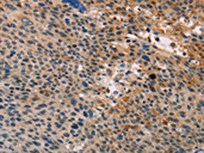 TLR1 Antibody