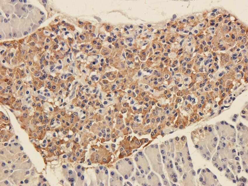TLR2 antibody