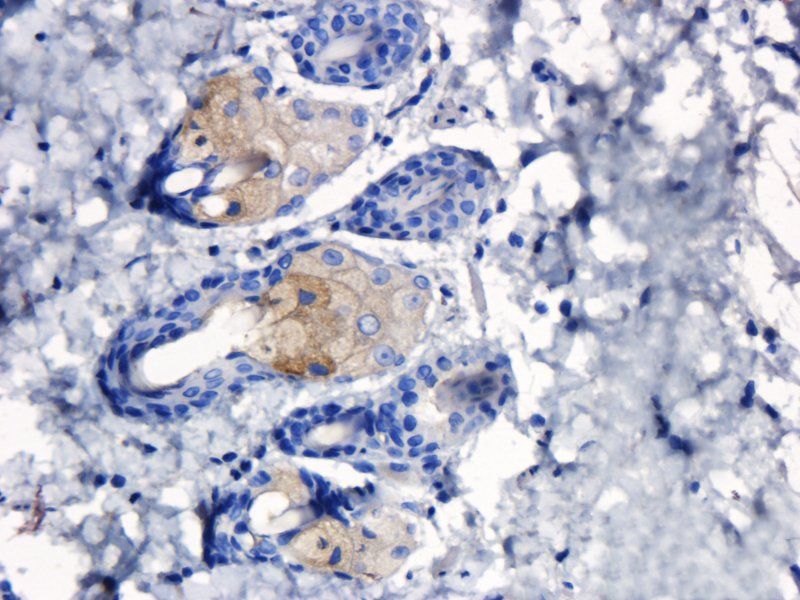 TLR2 antibody