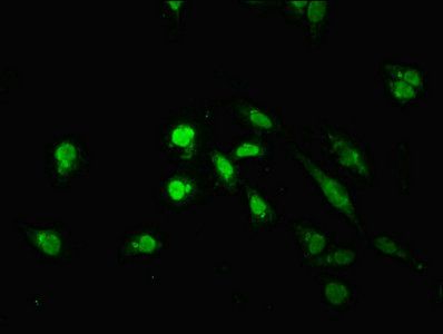 TM2D3 Antibody