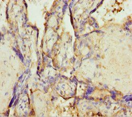 TMEM43 Antibody