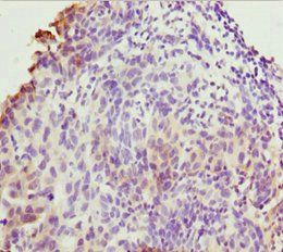 TMEM43 Antibody