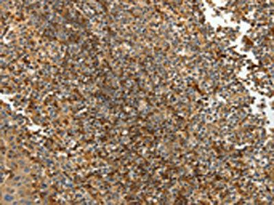 TMSB10 Antibody