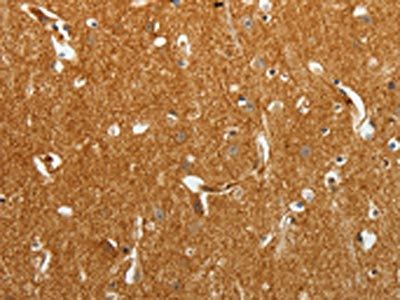 TMSB10 Antibody