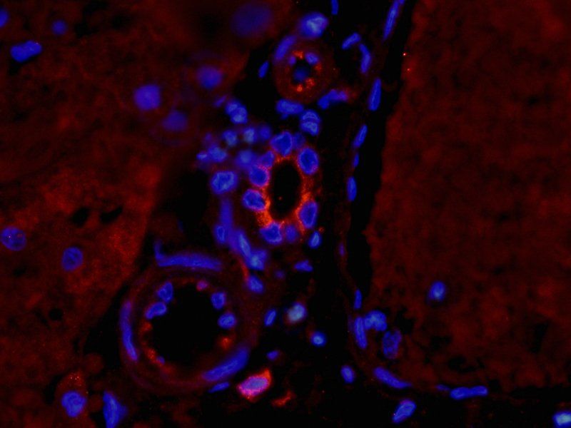 TNF alpha Rabbit Polyclonal Antibody