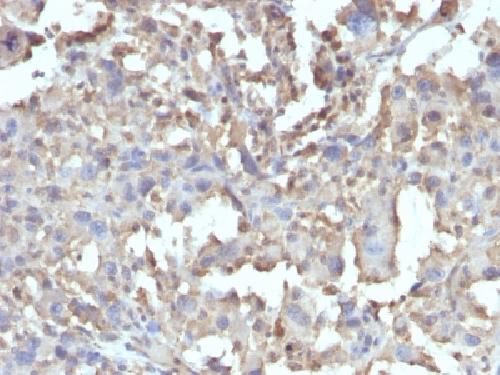 TNF Antibody