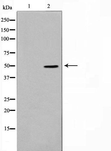 TNF Receptor II Antibody