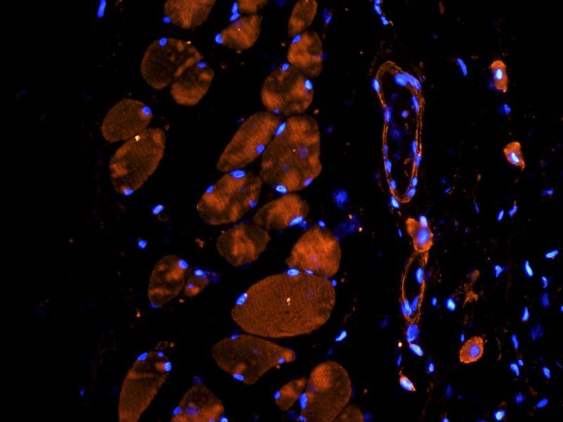 TNF alpha antibody