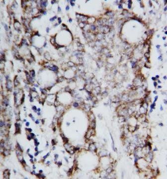 TNF beta/LTA Rabbit Polyclonal Antibody