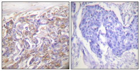 TNF Receptor I Antibody