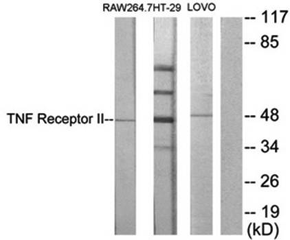 TNF Receptor II Antibody
