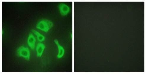 TNFA Antibody