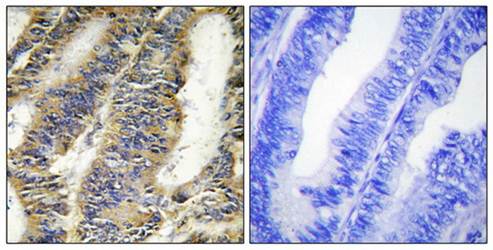 TNFA Antibody