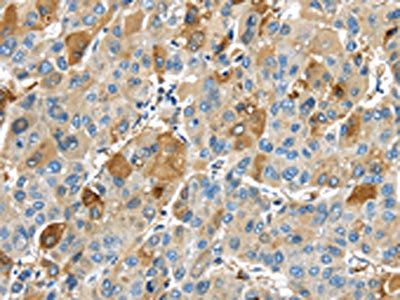 TNFAIP2 Antibody