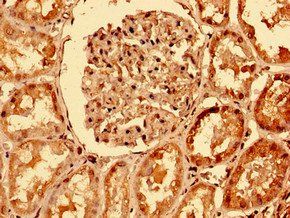 TNFRSF10A Antibody