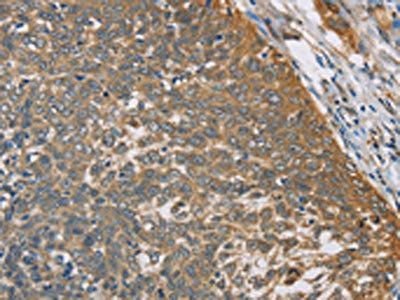 TNFRSF10D Antibody